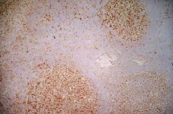 Anti Human CD40 Antibody, clone LOB7/6 gallery image 2