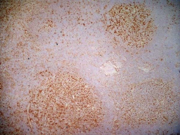 Anti Human CD40 Antibody, clone LOB7/6 thumbnail image 2