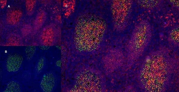 Anti Human CD40 Antibody, clone LOB7/6 gallery image 4