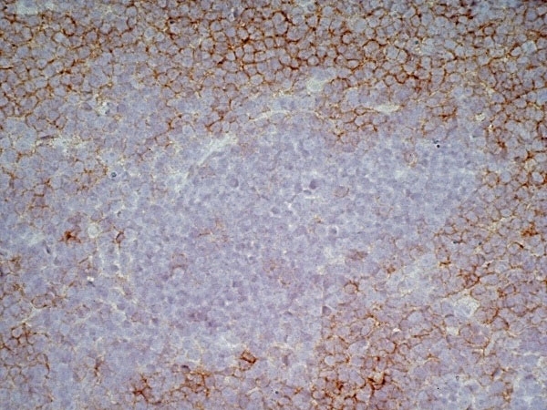 Anti Human CD43 Antibody, clone DFT-1 gallery image 9