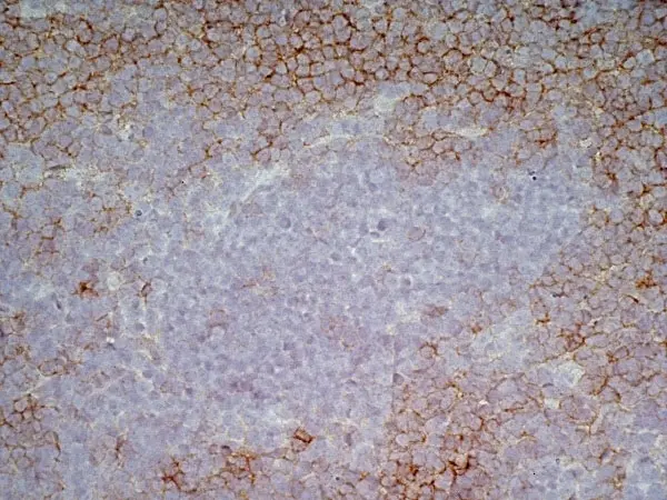 Anti Human CD43 Antibody, clone DFT-1 gallery image 9