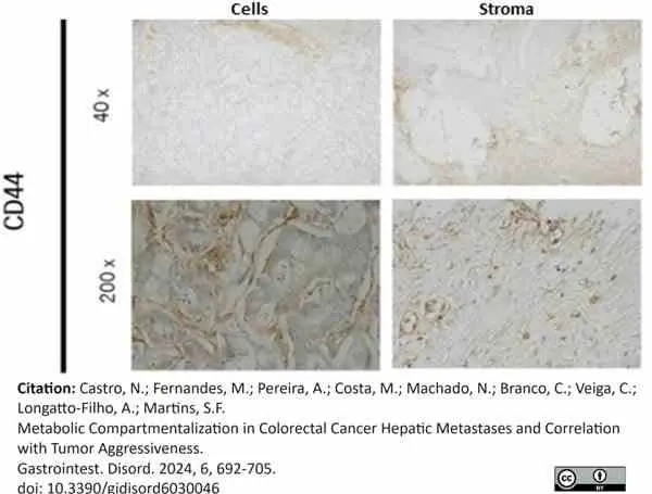 Anti Human CD44 Antibody, clone 156-3C11 (Monoclonal Antibody Antibody) gallery image 11