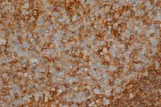 Anti Human CD44 Antibody, clone Bu52 gallery image 1