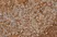 Anti Human CD44 Antibody, clone Bu52 thumbnail image 1