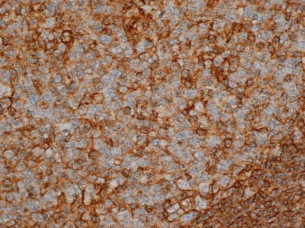Anti Human CD44 Antibody, clone Bu52 gallery image 1
