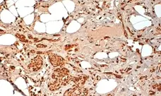 Anti Human CD44 Antibody, clone F10-44-2 gallery image 5