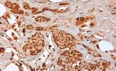 Anti Human CD44 Antibody, clone F10-44-2 gallery image 6