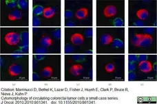 Anti Human CD45 Antibody, clone F10-89-4 gallery image 11