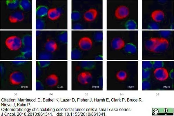 Anti Human CD45 Antibody, clone F10-89-4 gallery image 11