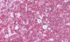 Anti Human CD45 Antibody, clone F10-89-4 gallery image 12