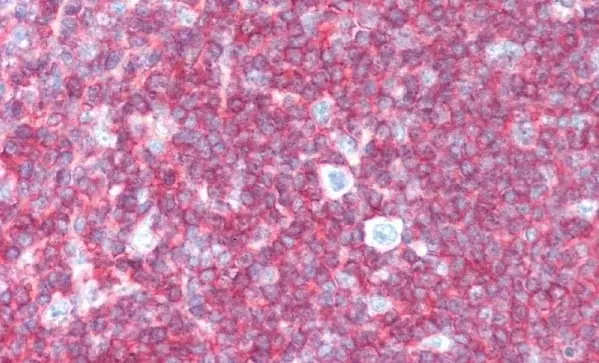 Anti Human CD45 Antibody, clone F10-89-4 gallery image 12