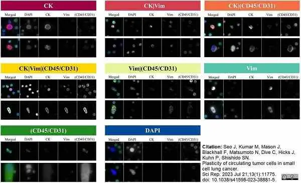 Anti Human CD45 Antibody, clone F10-89-4 gallery image 39