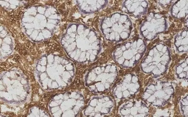Anti Human CD45 Antibody, clone F10-89-4 gallery image 4