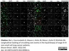 Anti Human CD45 Antibody, clone F10-89-4 gallery image 43