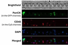 Anti Human CD45 Antibody, clone F10-89-4 gallery image 49
