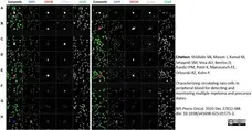 Anti Human CD45 Antibody, clone F10-89-4 gallery image 60