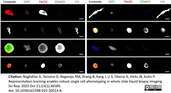 Anti Human CD45 Antibody, clone F10-89-4 gallery image 62