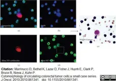 Anti Human CD45 Antibody, clone F10-89-4 gallery image 8