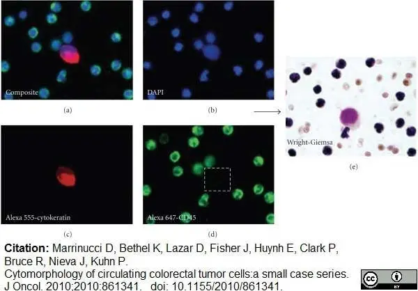Anti Human CD45 Antibody, clone F10-89-4 gallery image 8