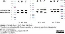Anti Human CD47 Antibody, clone BRIC126 gallery image 1