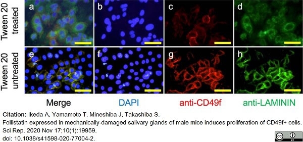 Anti Human CD49f Antibody, clone NKI-GoH3 gallery image 6