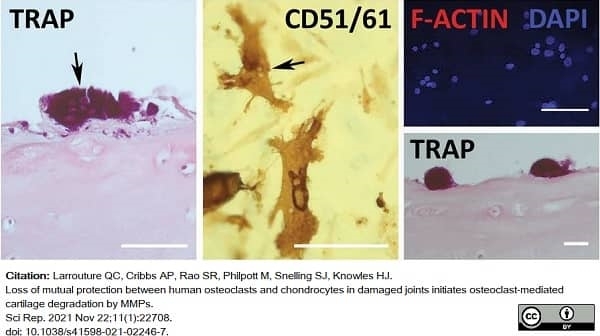 Anti Human CD51/CD61 Antibody, clone 23C6 gallery image 3