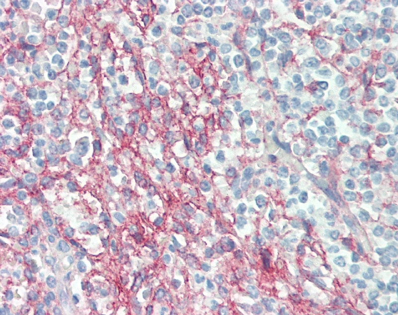 Anti Human CD54 Antibody, clone 15.2 gallery image 7