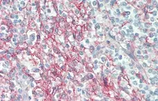Anti Human CD54 Antibody, clone 15.2 gallery image 8