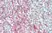Anti Human CD54 Antibody, clone 15.2 thumbnail image 8