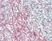 Anti Human CD54 Antibody, clone 15.2 thumbnail image 9
