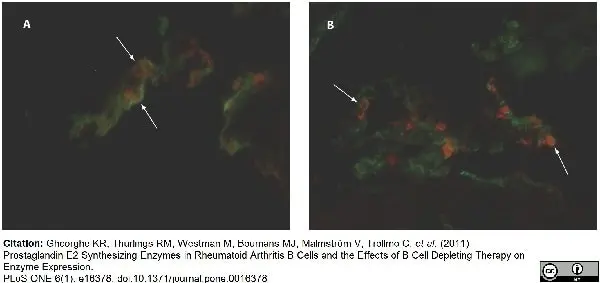 Anti Human CD55 Antibody, clone 67 gallery image 2