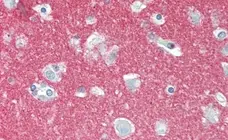 Anti Human CD56 Antibody, clone 123C3 gallery image 4