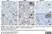 Anti Human CD56 Antibody, clone ERIC-1 thumbnail image 1