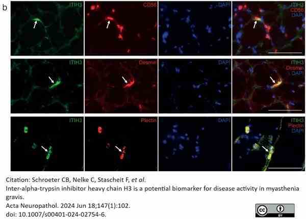 Anti Human CD56 Antibody, clone ERIC-1 gallery image 2