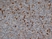 Anti Human CD57 Antibody, clone TB01 thumbnail image 1