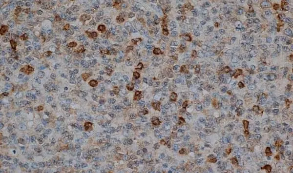 Anti Human CD57 Antibody, clone TB01 gallery image 2