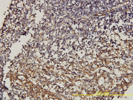 Anti Human CD58 Antibody, clone 2D11-B10 gallery image 2