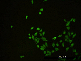 Anti Human CD58 Antibody, clone 2D11-B10 gallery image 3