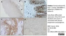 Anti Human CD58 Antibody, clone MEM-63 gallery image 6