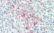 Anti Human CD61 Antibody, clone Y2/51 gallery image 4