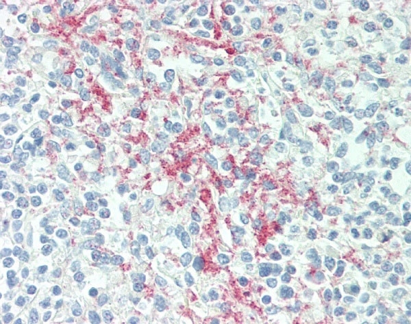 Anti Human CD61 Antibody, clone Y2/51 gallery image 3