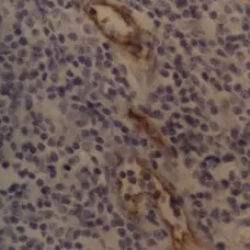 Anti Human CD62P Antibody, clone AK-6 gallery image 3