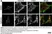 Anti Human CD63 Antibody, clone MEM-259 thumbnail image 17