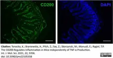 Anti Human CD64 Antibody, clone 10.1 gallery image 6