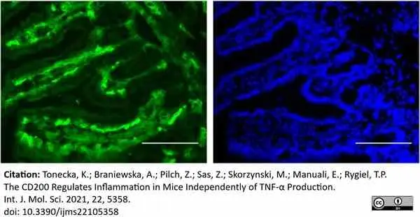 Anti Human CD64 Antibody, clone 10.1 | Bio-Rad