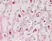 Anti Human CD66acd Antibody, clone YTH71.3 thumbnail image 2