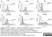 Anti Human CD66e Antibody, clone C365D3 (NCRC23) thumbnail image 2