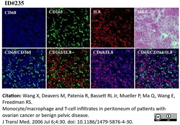 Anti Human CD68 Antibody, clone 514H12 gallery image 2