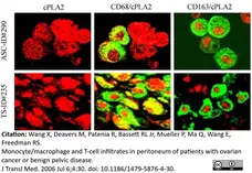 Anti Human CD68 Antibody, clone 514H12 gallery image 3