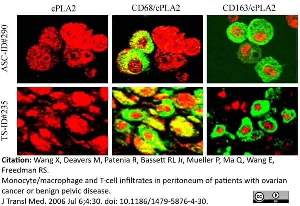 Anti Human CD68 Antibody, clone 514H12 gallery image 3